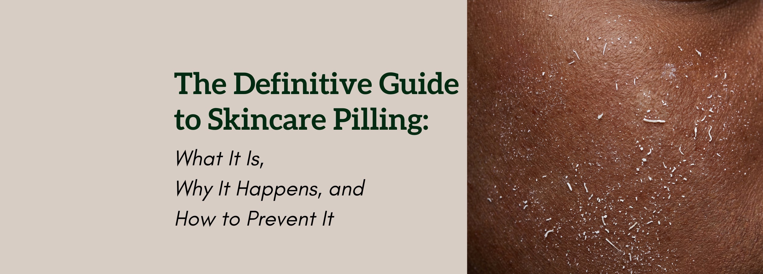 Close-up of melanin-rich skin with pilling from skincare 