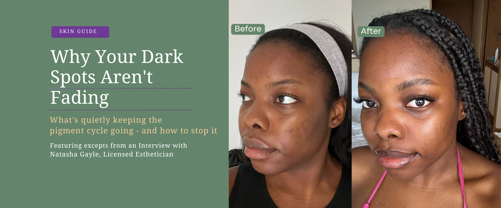 Why your dark spots are not working